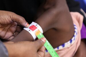 Somali Çocukları, Kesilen