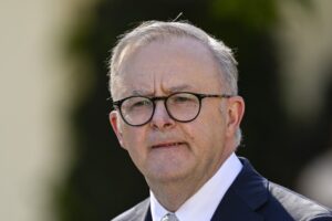 Albanese'den Yapay Zekâ